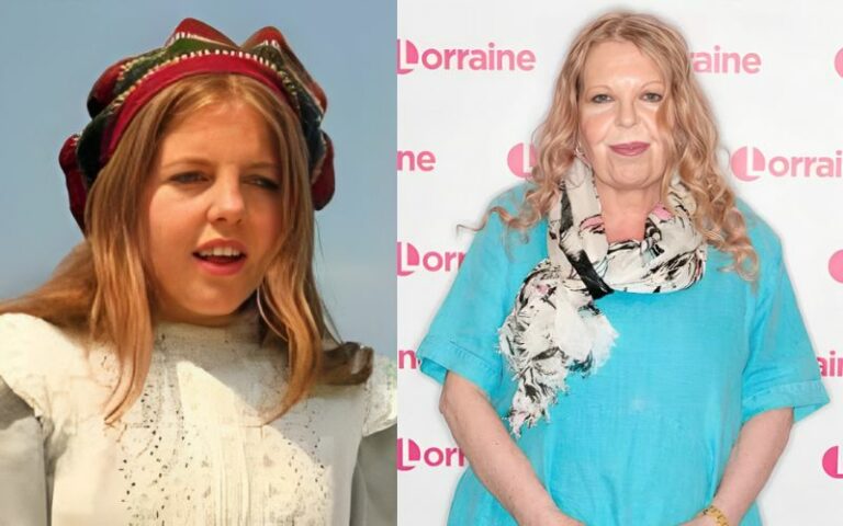Sally Thomsett Plastic Surgery